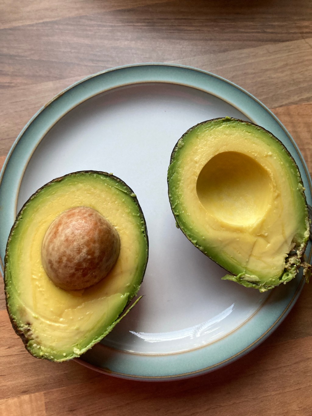 Non Diet Approach for Type 2&nbsp;Diabetes